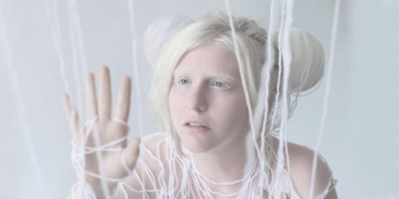 Was ist albino? Ursachen, Symptome und Behandlung von Albinismus