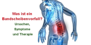 Was ist ein Bandscheibenvorfall? Ursachen, Symptome und Therapie