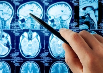 Gehirntumore wachsen im Takt der biologischen Uhr: Sogar die Behandlungszeit ist entscheidend